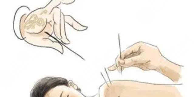 中醫(yī)中醫(yī)減肥