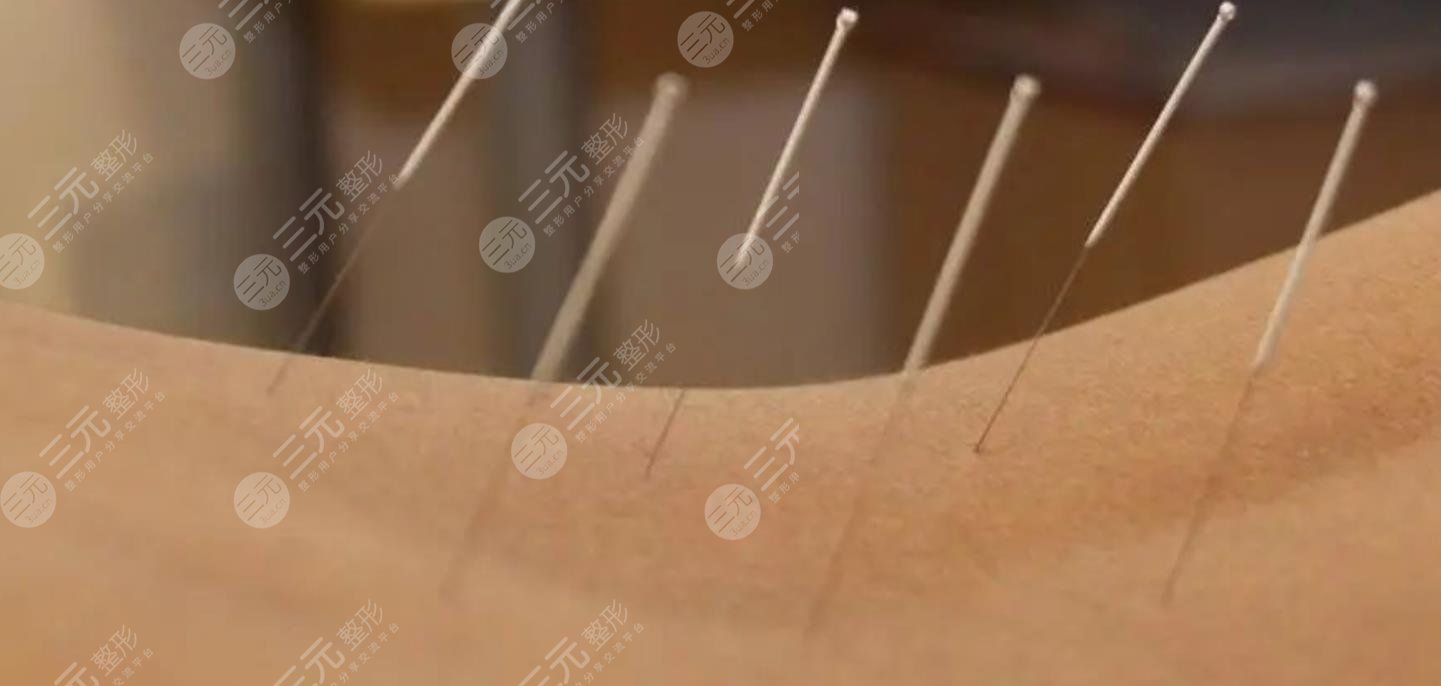 中醫(yī)中醫(yī)減肥