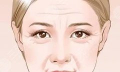 激光除皺和打注射除皺哪個(gè)好？抗衰項(xiàng)目入門科普，趕一趟醫(yī)美護(hù)膚的時(shí)髦！