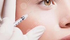 B****除皺的僵硬持續(xù)多久？價格&原理科普，別拿醫(yī)美當兒戲！