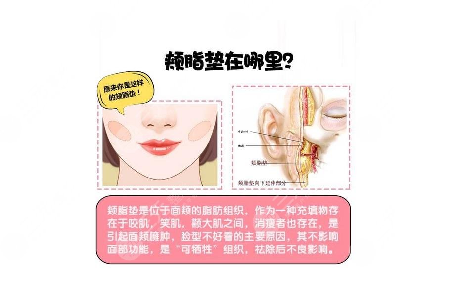 頰脂墊在哪個部位?