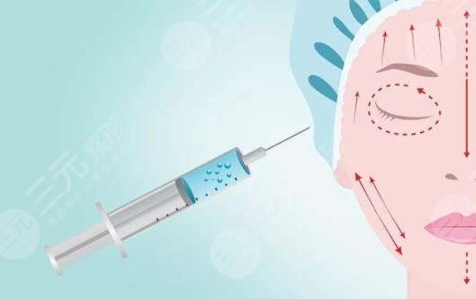 B****除皺的副作用有哪些