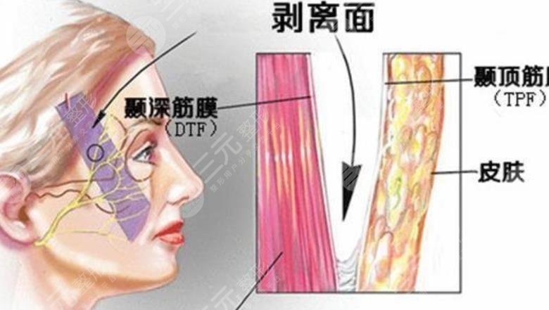 中面部抗衰術(shù)優(yōu)勢(shì)有什么