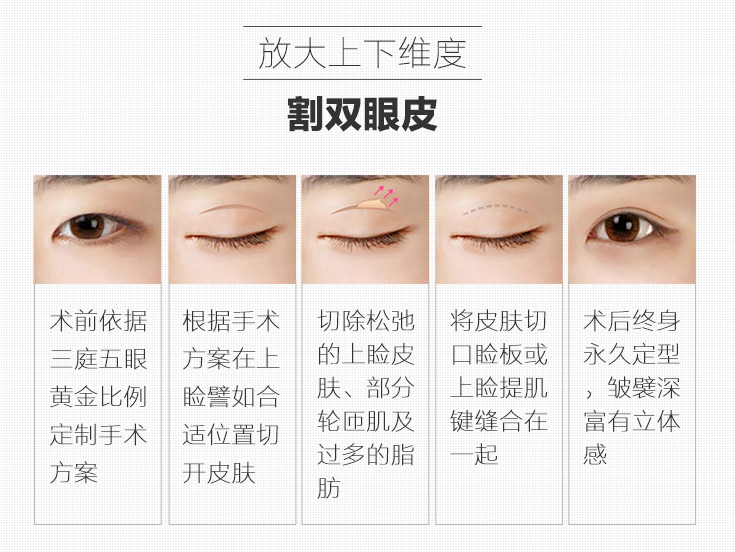 割雙眼皮后1-7天恢復圖文科普來咯！注意事項教你，助力靚麗大眼！