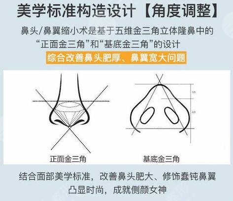 鼻翼縮小手術(shù)費(fèi)用大概是多少錢，降低風(fēng)險嗎？價格參考&術(shù)后護(hù)理指南！