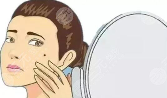 激光去痣能夠維持多長時間