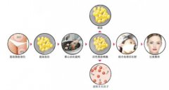 面部填充有什么后遺癥，危害大嗎？費(fèi)用&注意事項全科普，要美不要坑！