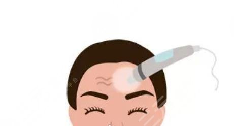 極速提拉面頸部