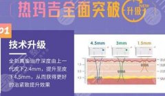 熱瑪吉可以長期做嗎？抗衰不能“貪”！注意事項科普~