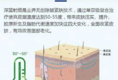 深藍射頻的作用原理&注意事項，親民又白菜，這種抗衰醫(yī)美別錯過！