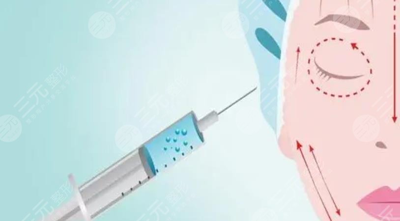 玻尿酸注射
