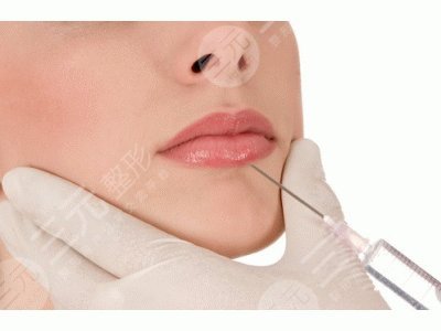 玻尿酸豐唇手術(shù)一般能維持多長時(shí)間?