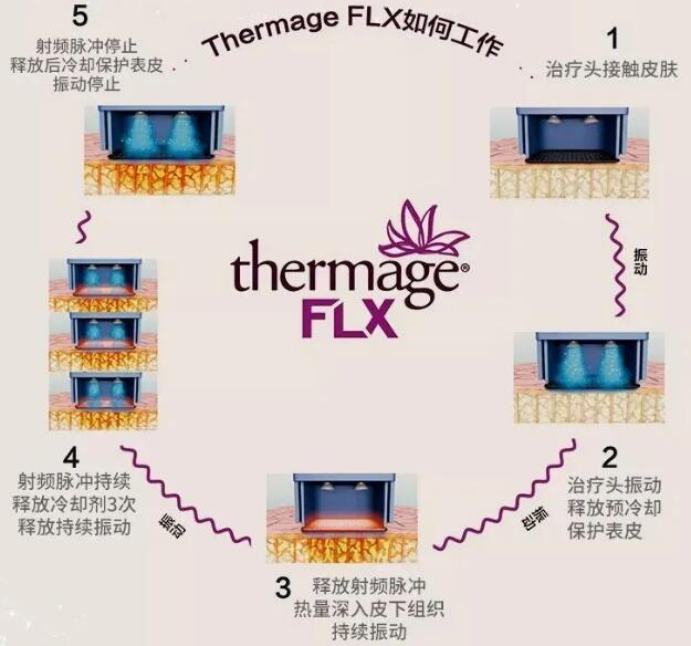 新一代熱瑪吉FLX儀器多少錢一次？功維持多久？2022美膚攻略！