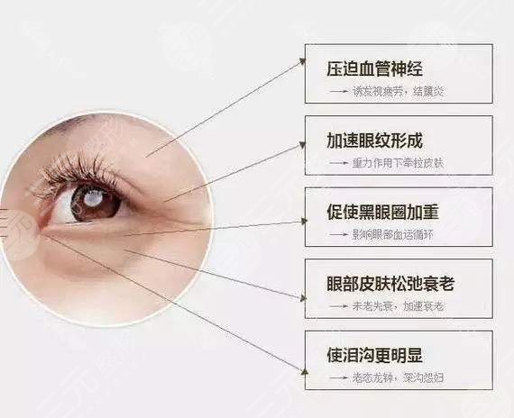 去眼袋降低風(fēng)險(xiǎn)有的方法|動(dòng)手術(shù)好還是微創(chuàng)好?1分鐘了解~