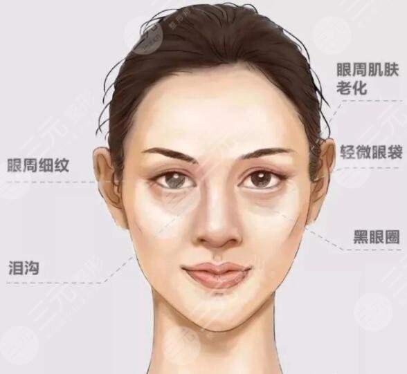 中面部抗衰影響恢復(fù)期的幾個(gè)因素解析