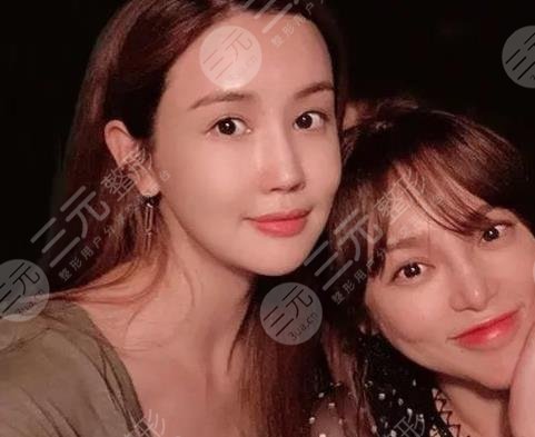 李多海整容多次變臉失??？成韓國整形反面教材！盤點她的整容歷程