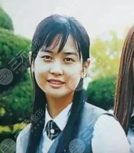 韓國整形反面教材李多海