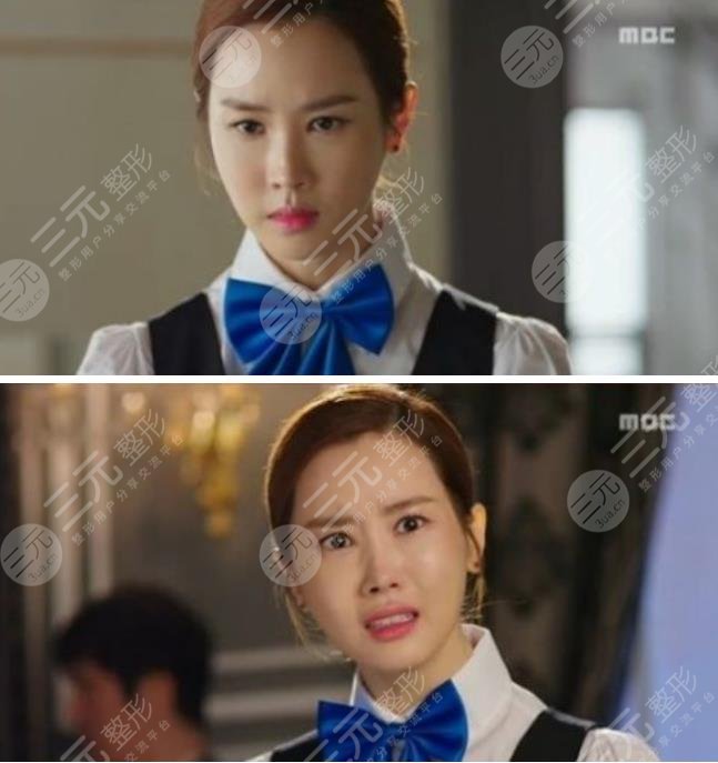 李多海整了那些地方?