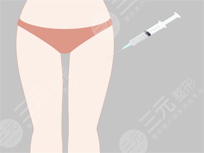 大腿部吸脂減肥果前后對比圖 大腿部吸脂手術恢復全過程