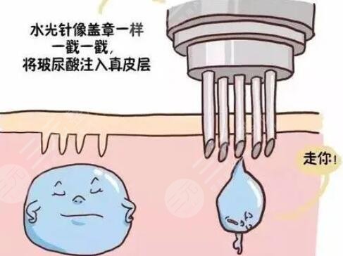 注射了水光補(bǔ)水皮膚變好了 水光補(bǔ)水注射后注意事項(xiàng)