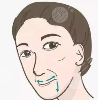 西安西京醫(yī)院假體隆鼻手術(shù)一個(gè)月過程恢復(fù)對(duì)比圖分享實(shí)錄