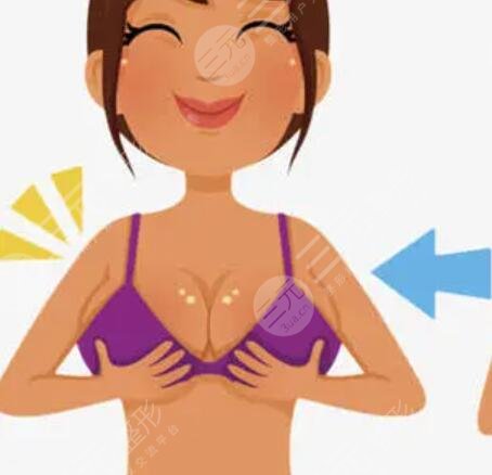 娜綺麗隆胸一個月