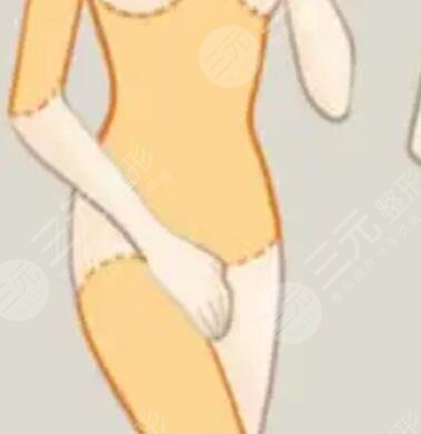 肚子上的贅肉怎么減 腹部吸脂手術(shù)對(duì)比照片