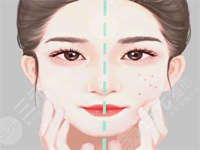 自體脂肪面部填充讓我恢復(fù)年輕美貌