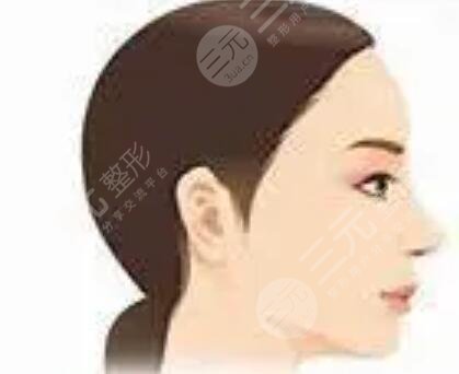 3度仿生美鼻+彩光祛雀斑+多維立體豐下頦前后對(duì)比果圖片