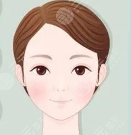 玻尿酸填充,去除法令紋