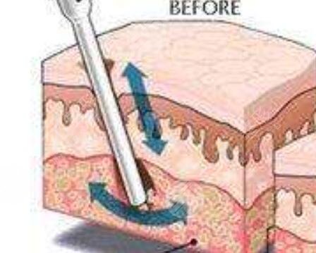 成都銅雀臺(tái)的教你如何瘦手臂【日記】