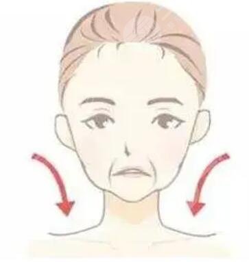 自體脂肪面部填充手術(shù)案例 前后果對(duì)比