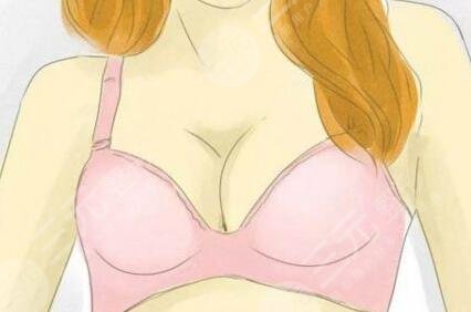 自體脂肪豐胸果對(duì)比|武侯黃氏百佳整形反饋