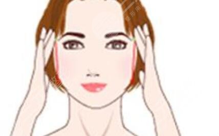 削骨手術親身經(jīng)歷分享，小方臉逆襲瓜子臉~