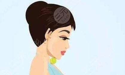 麗星整形魏醫(yī)生假體隆鼻案例術(shù)前