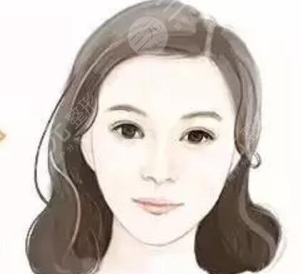 墊下巴案例 假體墊下巴恢復過程分享