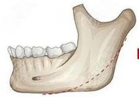 北大口腔正畸案例經(jīng)典
