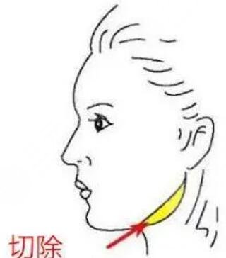 北大口腔正畸案例經(jīng)典