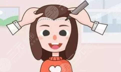 洛陽(yáng)三院植發(fā)果怎樣