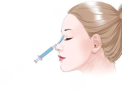 八大處范飛隆鼻案例圖 價(jià)格