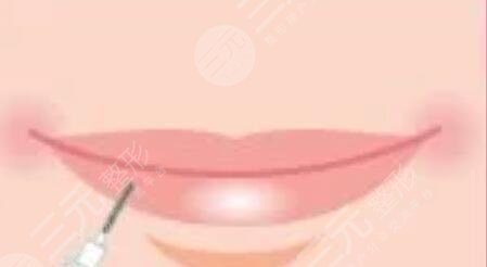 漂唇恢復(fù)七天過程圖，附個(gè)人漂唇經(jīng)歷過程圖片