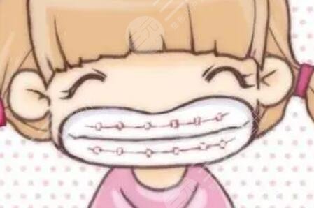 南海拜博口腔醫(yī)院怎么樣？附個(gè)人牙齒矯正經(jīng)歷分享