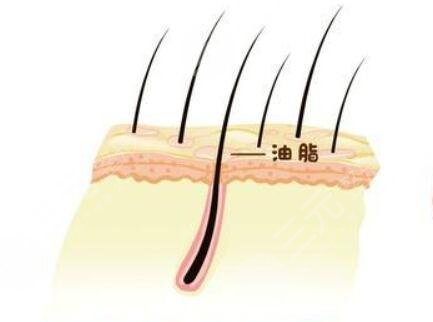 南京新生植發(fā)靠譜嗎?附發(fā)際線植發(fā)的真實(shí)經(jīng)歷