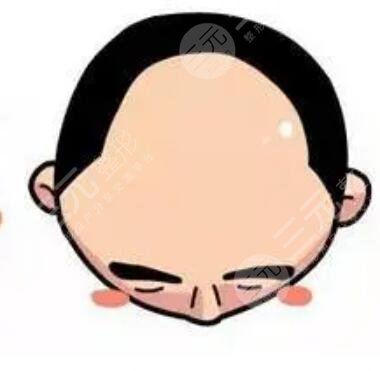 石家莊叢生植發(fā)醫(yī)院醫(yī)生介紹