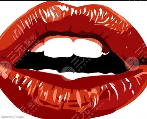 厚唇改薄七天恢復(fù)圖