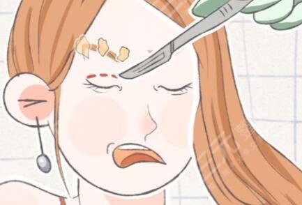 美瞳線一到七天恢復(fù)過程圖：七天左右