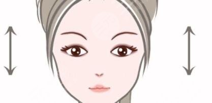 開(kāi)扇雙眼皮案例圖片