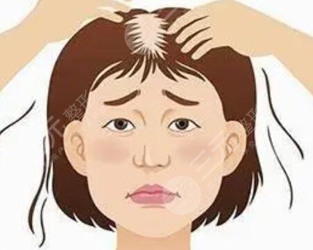 蘭州雍禾植發(fā)醫(yī)院發(fā)際線(xiàn)改良案例