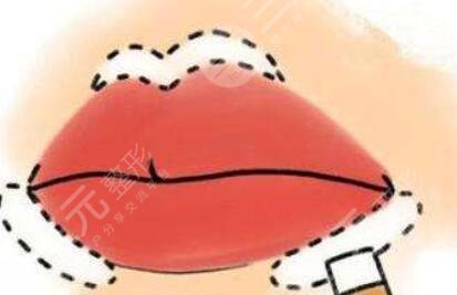 m唇手術(shù)對(duì)比照