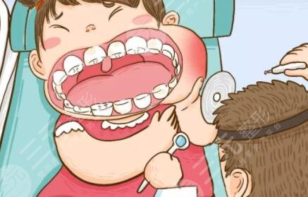 昆明尚愛韓美口腔醫(yī)院怎么樣？種植牙果如何？附醫(yī)院價格表